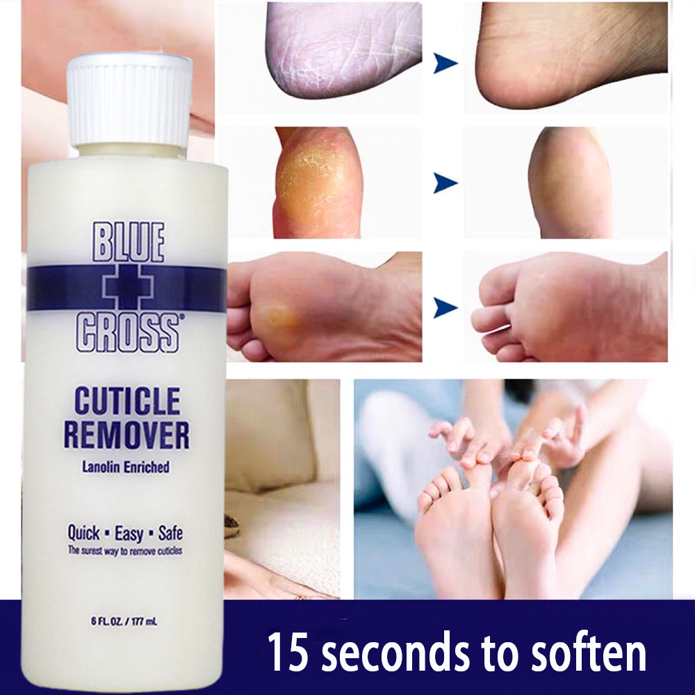 Foot Mask Peeling - 足の角質除去剤、死んだ皮膚を柔らかくする角質除去剤、死んだ皮膚や角質を除去するフットマスク、ペディキュアネイルエンハンサー、死んだ皮膚を除去します