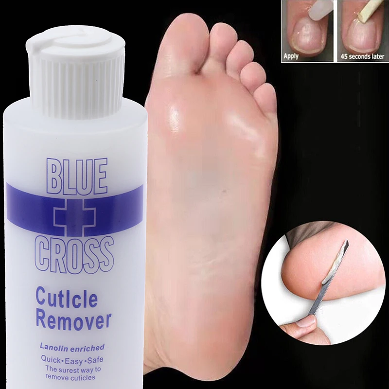Foot Mask Peeling - 30/177ml フットキューティクルリムーバー デッドフットエクスフォリエーター ソフトナー 死んだ皮膚や角質を除去 フットマスク