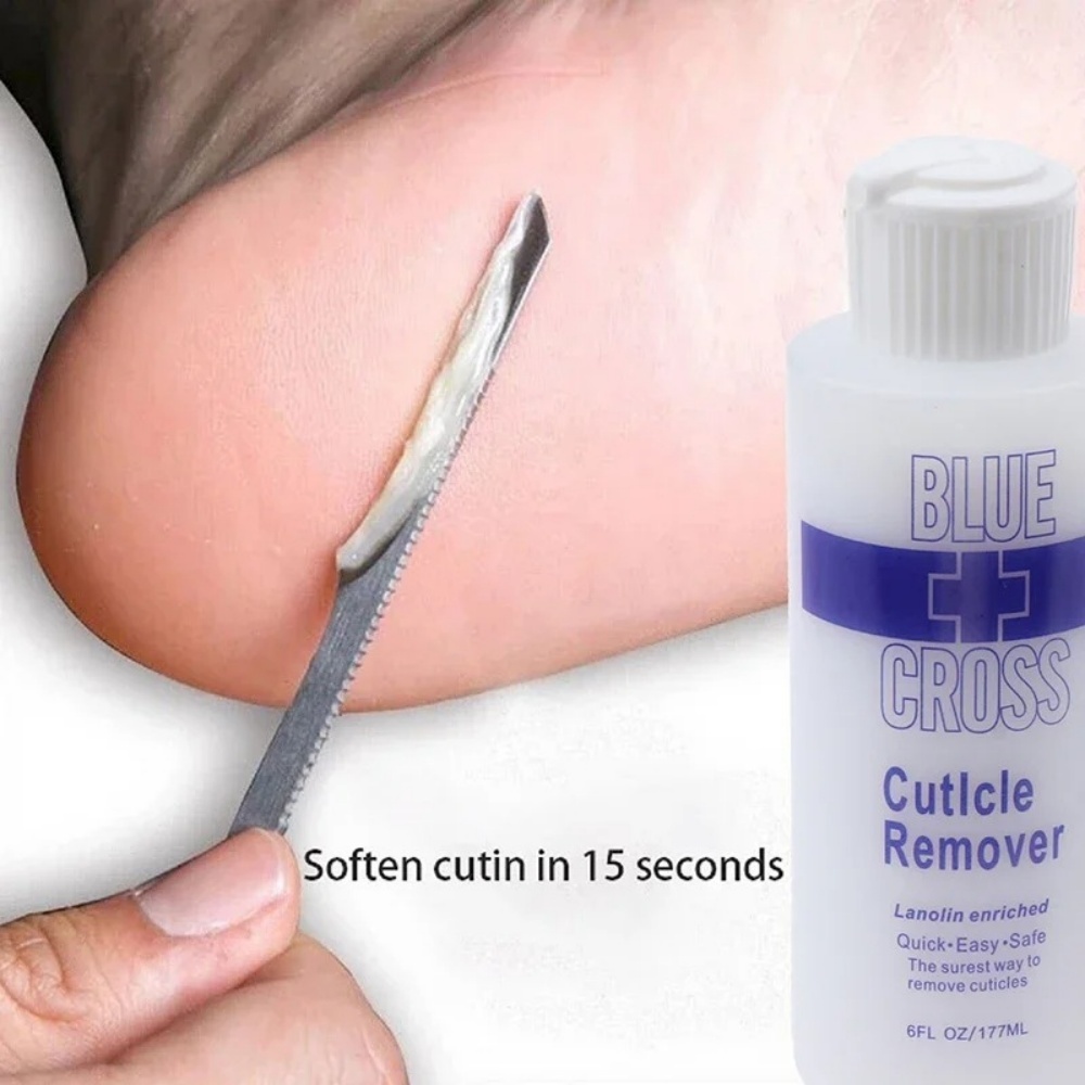 Foot Mask Peeling - 177ml フットキューティクルリムーバー、足の角質除去剤、柔軟剤、死んだ皮膚や角質の除去、フットマスクケアツール、ペディキュアネイルエンハンサー