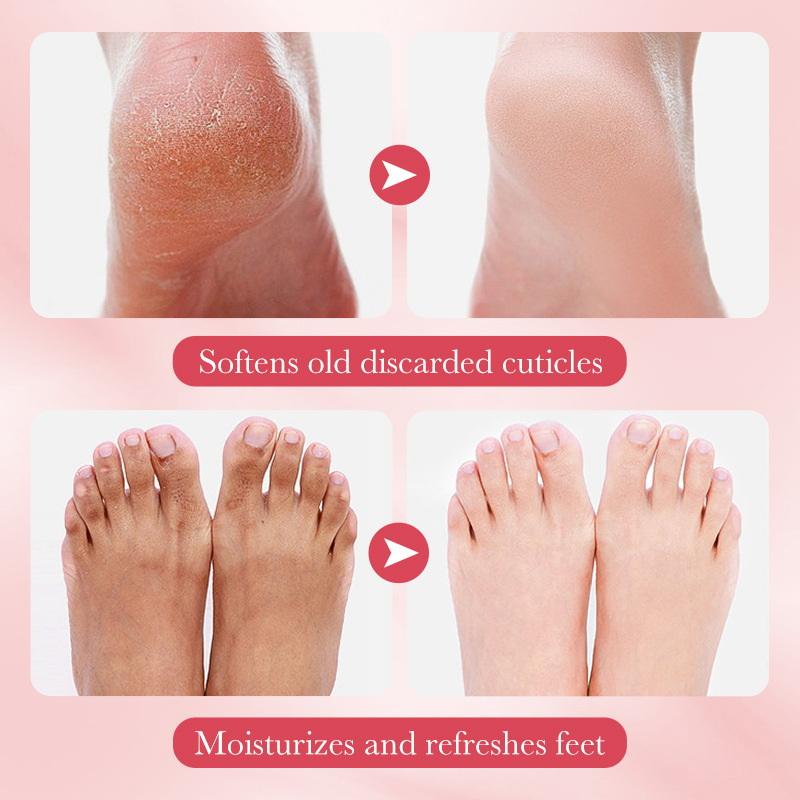 Foot Mask Peeling - 1ペア SADOER フルーツフットマスク 保湿フットピーリングマスク 角質除去 フットスパ