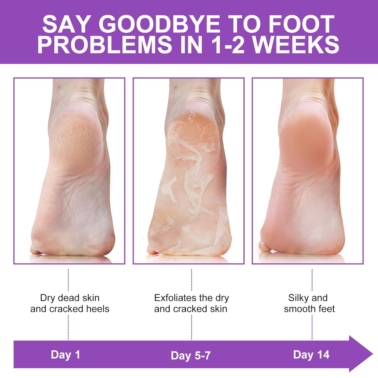 角質除去ピールカルス死皮フットマスクソックスリムーバースパス - Foot Mask Peeling のレビューと価格