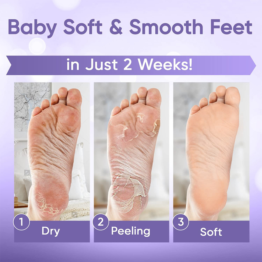 1-20 ペア角質除去足マスク角質除去フットピールマスク靴下 - Foot Mask Peeling のレビューと価格