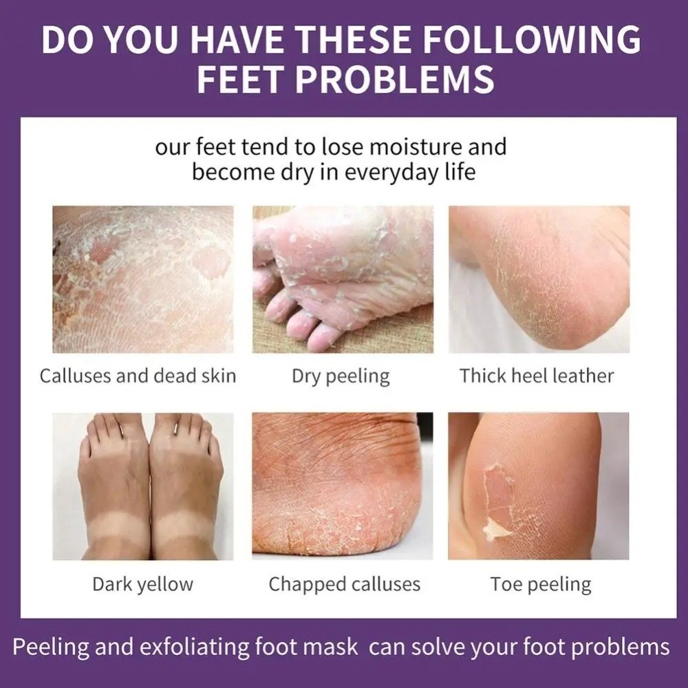 ラベンダー保湿角質除去フットマスク、角質修復保湿フットピール - Foot Mask Peeling のレビューと価格