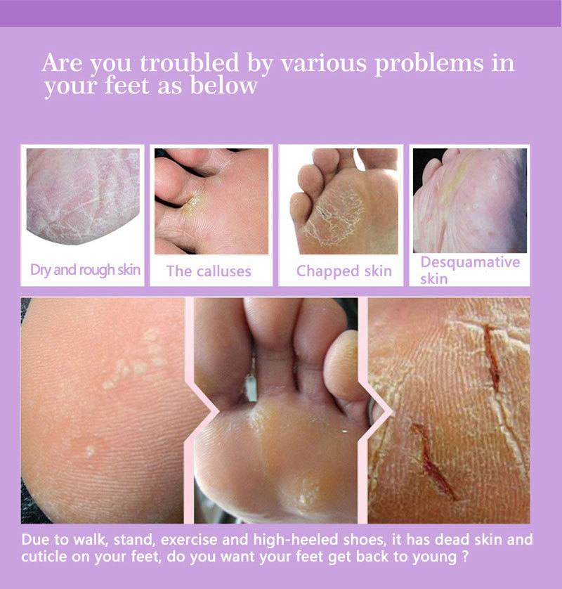 足用角質除去フットマスク ペディキュアソックス 角質除去スク - Foot Mask Peeling のレビューと価格