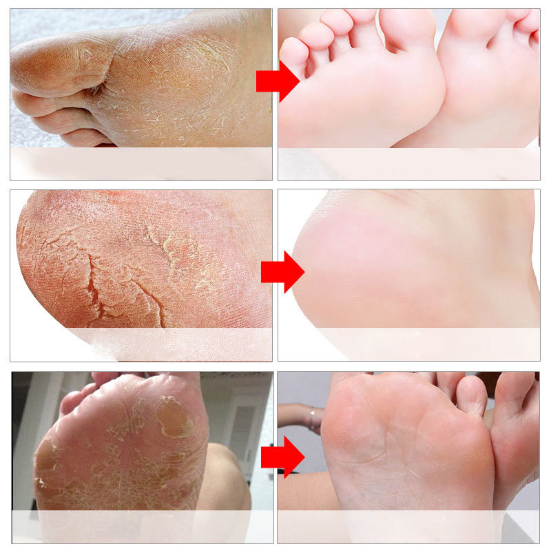 足用角質除去フットマスク ペディキュアソックス 角質除去スク - Foot Mask Peeling のレビューと価格